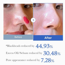 Indlæs billede til gallerivisning Medicube Zero Pore Pad 2.0 – eksfolierende toner pads gauasha.com