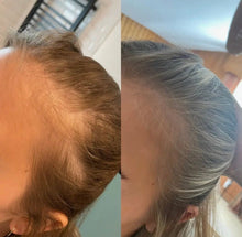 Indlæs billede til gallerivisning Yuaia Rosemary Hair & Scalp Oil – Stimulerer hårvækst & plejer hovedbunden (50 ml) gauasha.com