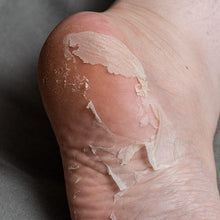 Indlæs billede til gallerivisning Exfoliating Peeling Socks ( dem hvor huden skaller af ) gauasha.com
