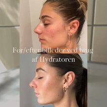 Indlæs billede til gallerivisning Kyst Care Hydrator serum - 30 ml gauasha.com
